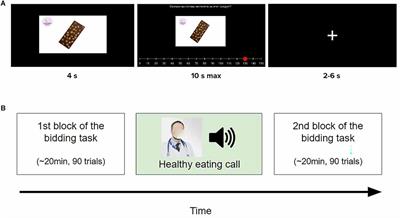 Neural mechanisms of expert persuasion on willingness to pay for sugar